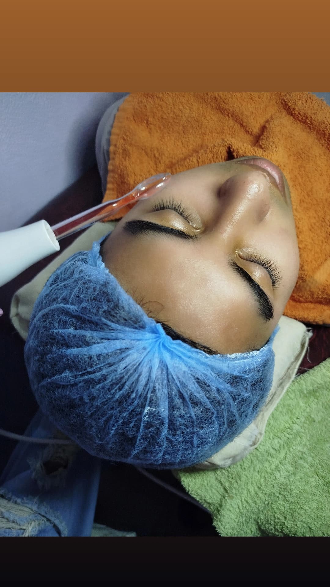 Radiofrecuencia Facial en Trelew